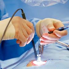 Laparoscopy